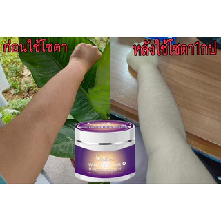 โลชั่นโซดาไวท์ เปิดบิล5กระปุก
