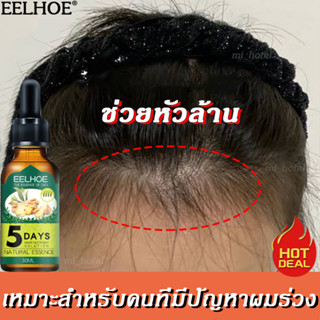 EELHOE เซรั่มปลูกผม 30ml ป้องกันผมร่วง บำรุงผม น้ำยาปลูกผม ปลูกผม ทำให้รากผมแข็งแรงมากขึ้น ยาปลูกผมของแท้ Hair Growth