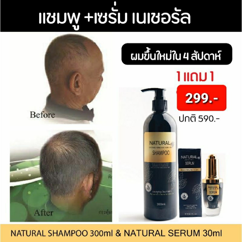 ลด50%🔥โปรแรง1แถม1🔥แชมพูเนเชอรัล+เซรั่ม สูตรลดผมมัน ดูแลผมร่วง