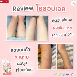 Aiaoon โรสฮิปเจล บำรุงผิว "ลดรอยดำ" aiaoon Natural Rosehip Gel for Face and Body**แบบซอง**