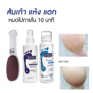 มินิเซ็ต ที่ขัดส้นเท้าญี่ปุ่นด้ามขาว➕Foot Callus 180ml.➕Mousse #3 Footlogix ของแท้นำเข้าจากCANADA🇨🇦 พร้อมส่ง