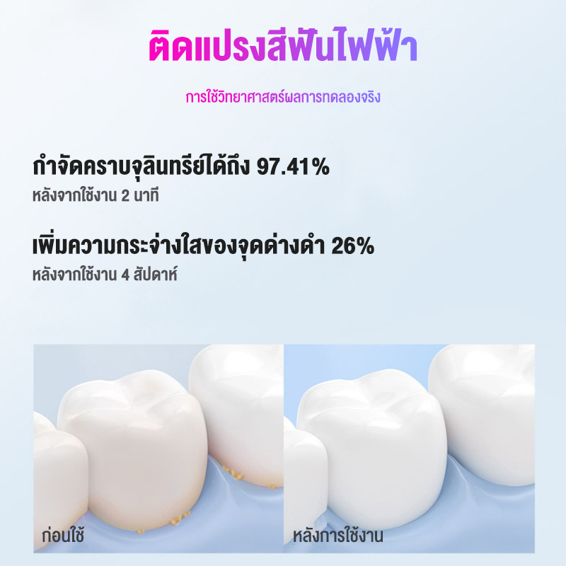 ปรงสีฟันไฟฟ้า+หัวแปรง2หัว Electric Toothbrush อัตโนมัติ กันน้ำ ใช้แบตเตอรี่แปรงสีฟัน แปรงได้สะอาด ดีต่อเหงือกและฟัน -655