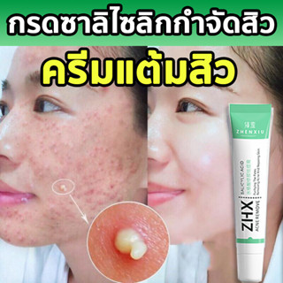 🌷ZHENXIU ครีมรักษาสิว ครีมแต้มสิว ครีมลดสิว ทำให้ใบหน้าสะอาดและขาวใส🌷 20g【COD】