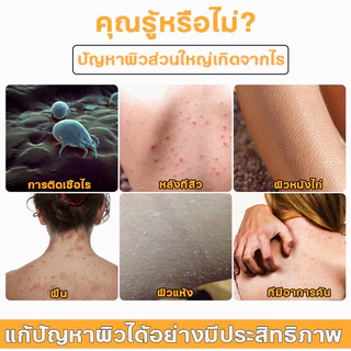 Body wash ครีมอาบน้ำ ครีมอาบน้ำลดสิว 300ml ต่อต้านเชื้อราแก้คัน ให้ความชุ่มชื้นอ่อนโยน กลิ่นหอมติดทน ลดสิว กำจัดไร คุมน้