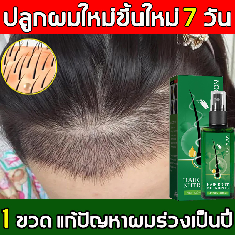เห็นผลภายใน3วัน ยาปลูกผมผู้ชาย 120ml( ยาปลูกผม น้ำยาเร่งผมยาว เซรั่มปลูกผม ปลูกผมเร่งด่วน ปลูกผม ยาปลูกผมของแท้ สเปรย์ป