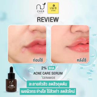 CHER BHA Acne Care Serum+Ceramide เฌอ เซรั่มละลายหัวสิว ลดสิวอุดตัน
