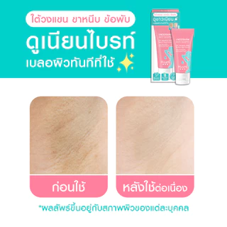 [แพ็คคู่] MizuMi Underarm White Booster 30g บำรุงผิวใต้วงแขน ขาหนีบ ข้อพับ ให้ดูเรียบเนียน เบลอผิวทันทีที่ใช้