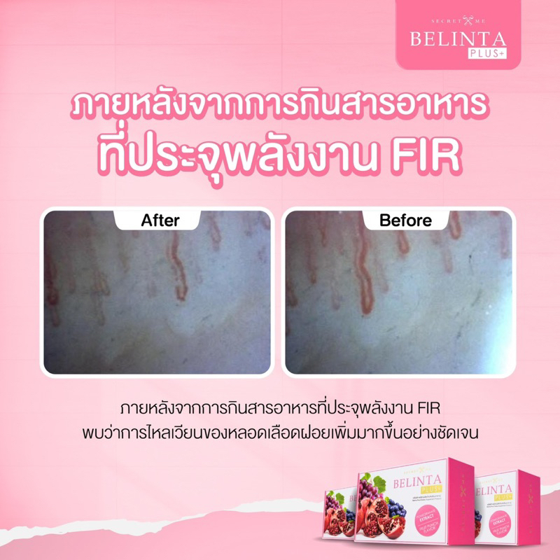 ✦เบลินต้าพลัส  ✦  (คูปอง 𝗹𝗶𝘃𝗲 𝟯𝟬%) ✨🔥𝗕𝗲𝗹𝗶𝗻𝘁𝗮 𝗣𝗹𝘂𝘀 ผิวใส ผิวลื่นผิวฉ่ำ ผิวอิ่มน้ำ - รูปที่ 4