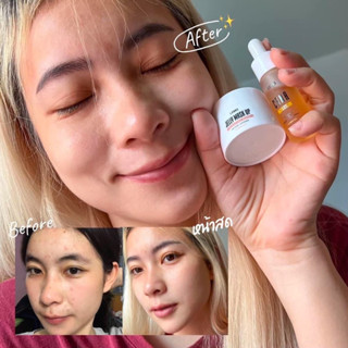 โปร🌟ลด50%🌟ของเเท้//พร้อมส่ง เจลลี่มาร์กอัพ ลดสิว ผิวหน้าแข็งแรง แพ้ง่ายใช้ได้