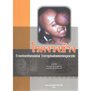 [หนังสือ] โรคงวงช้าง Frontoethmoidal Encephalomeningocele ตำรา แพทย์ แพทยศาสตร์ ผ่าตัด ศัลยกรรม ศัลยศาสตร์ surgery