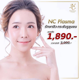 NC Plasma รักษาสิว ที่ Natchaya Clinic [Gift Voucher]