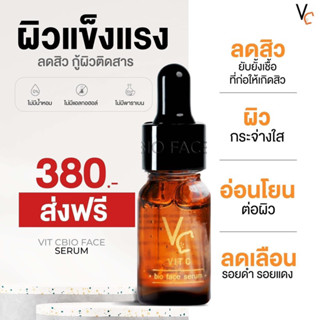 เซรั่มวิตซี วิตซีน้องฉัตร วิตซีลดสิว