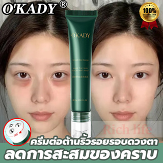 OK’ADY ครีมต่อต้านริ้วรอยรอบดวงตา15ml อายครีม มาพร้อมหัวลูกกลิ้งนวด 3 หัว นวด360°กระชับรอยตีนกา บรรเทาปัญหาต่างๆรอบดวงตา