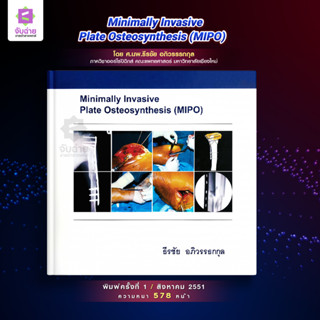 Minimally Invasive Plate Osteosynthesis (MIPO)