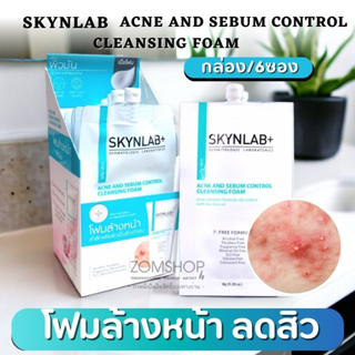 【Skynlab】โฟมล้างหน้า ระดับพรีเมี่ยม ✨【ลดสิว ลดความมัน อ่อนโยน ผิวแพ้ง่าย 】Acne And Sebum Control Cleansing Foam