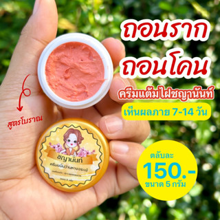 ครีมไฝชญานันท์ขมิ้นวานห่างจระเข้ ไฝ ขี้แมลงวัน ติ่งเนื้อ หูด ตาปลา ปาน จบทุกปัญหา