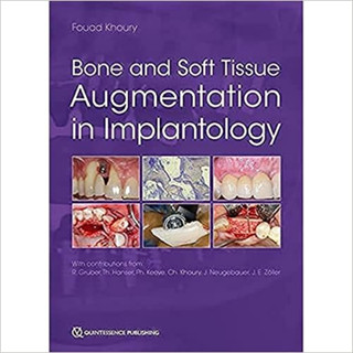 Bone and Soft Tissue Augmentation in Implantology (Hardcover)/Fouad Khoury ISBN:9781786981042