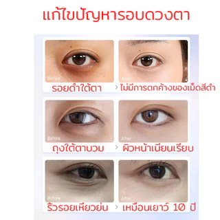 【ของแท้ พร้อมส่ง】ครีมบำรุงรอบดวงตา 20G ดูแลรอบดวงตาและ ครีมลดถุงใต้ตา ลดรอยคลำ้ใต้ตาลด ริ้วรอย