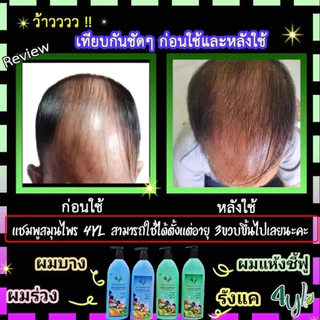 🍀(ขวดใหญ่ 400 มล.) แชมพูสมุนไพรสุดยอดมหัศจรรย์ 4YL Thailand แชมพูสมุนไพร จากสารสกัดธรรมชาติ แท้ 100%