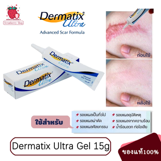 Dermatix Ultra Gel 15g เดอร์มาติกซ์ อัลตร้า เจล ครีมลดรอยแผลเป็น ครีมรักษาแผลเป็น ครีมลบรอยแผลเป็น