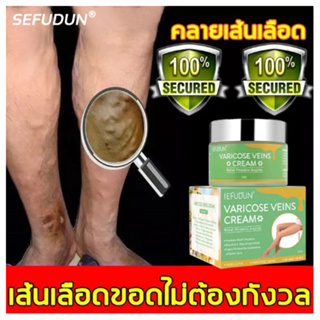 SEFUDUN รักษาเส้นเลือดขอด ยาทาเส้นขอด เส้นเลือดขอด 50g รักษาขาให้สวย รักษาขาให้สวย ครีมหลอดเลือดดำบอกลาเส้นเลือดขอด