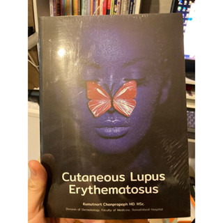 🔥ถูกสุด ใน shopee cutaneous Lupus erythematosus ramathibodi hospital