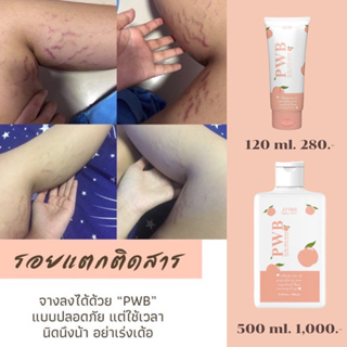 PWB ครีมแก้รอยแตกลาย ของแท้100%  จัดการผิวดำสากดำด้าน