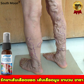 South Moonสเปรย์ฉีดเส้นเลือดขอด30ml ส่งเสริมการไหลเวียนโลหิต บรรเทาอาการ ลดอาการบวมที่ขา ครีมทาเส้นขอดแผ่แปะเส้นเลือดขอด