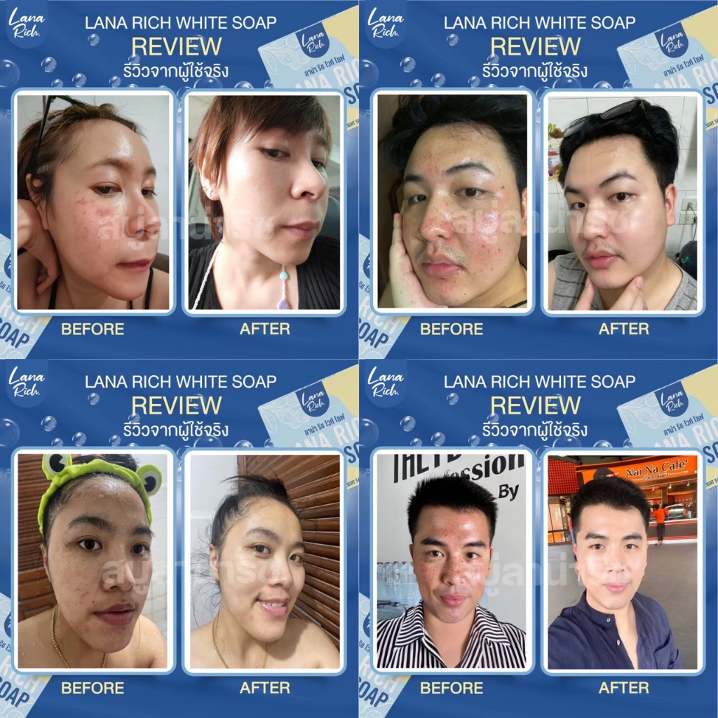 ขายดีมาก!! สบู่ลาน่า ริช LANA RICH WHITE SOAP รูปที่ 2