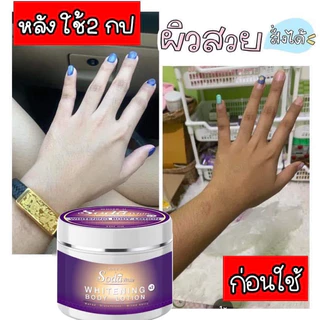 โลชั่นโซดาไวท์ เปิดบิล5กระปุก