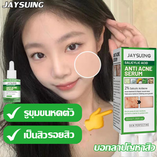 ลบสิวโดยไม่ทิ้งรอย สเปรย์ฉีดสิว ครีมลดสิว กำจัดสีว สิวอุดตันซ่อมแซมรอยสิวAcne cream ลดสิวถาวร ซ่อมแซมรอยสิว