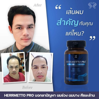 HERRMETTO PRO ผลิตภัณฑ์ดูแลเส้นผมผู้ชาย ผมร่วง ผมบาง (ของแท้100% สำหรับผู้ชายโดยเฉพาะ)