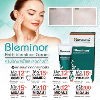 ครีมรักษาฝ้ากะและจุดด่างดำ รอยแกะสิว  Himalaya Bleminor 30 ml