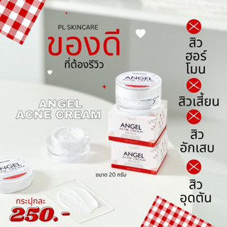 ตะกร้า 51 แองเจิ้ลแอคเน่ครีม กระปุกใหญ่ 20 กรัม  Angel Acne Cream แองเจิ้ล แอคเน่ครีม ลดสิว ฝ้ากระ จุดด่างดำ