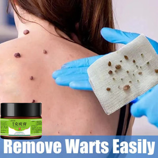 ครีมบํารุงผิวเท้า กลิ่นข้าวโพด Warts 20 กรัม