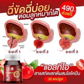 ผลิตภัณฑ์เสริมอาหาร ตราเเอลทีโอ ฉี่ไม่สุดฉี่บ่อย