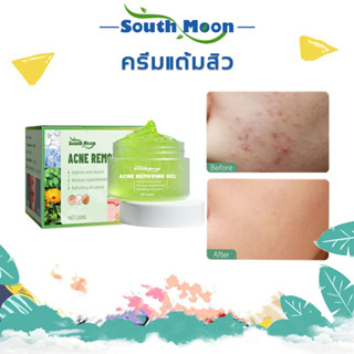 【จัดส่งจากกรุงเทพฯ】South Moon ครีมลดสิว ครีมใบบัวบก ครีมทาฝ้า 30ml สูตรสมุนไพรธรรมชาติ ลดสิวฝ้ากระ