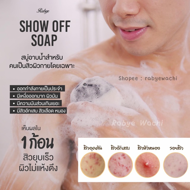 Rabye (ส่งฟรี) สบู่ลดสิวผิวกาย ลดการอักเสบ ยับยั้งการเกิดสิว ผิวขาวใส (สบู่โชว์ออฟ Show off soap)