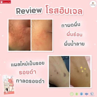 Aiaoon โรสฮิปเจล บำรุงผิว "ลดรอยดำ" aiaoon Natural Rosehip Gel for Face and Body**แบบซอง**