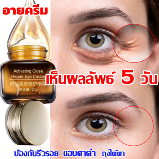 【ของแท้ พร้อมส่ง】ครีมบำรุงรอบดวงตา 20G ดูแลรอบดวงตาและ ครีมลดถุงใต้ตา ลดรอยคลำ้ใต้ตาลด ริ้วรอย