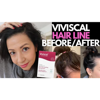วิตามินบำรุงเส้นผม Viviscal Advanced Hair Health ผมบาง ผมร่วง สำหรับผู้หญิง 100% Drug Free