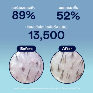 DIVYNE Strand Saviour Intensive Hair Serum 50ml เซรั่มลดผมร่วง เพิ่มดกหนา ปกป้องผมเสีย ล็อคสีผม