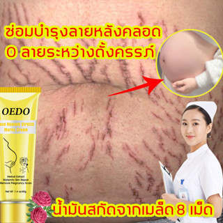 สูตรธรรมชาติบริสุทธิ์ OEDO ครีมท้องแตกลาย เป็นคุณแม่ดูเซ็กซี่ไร้รอยแตกลาย! (ครีมทาท้องลาย ครีมแก้ท้องลาย ครีมหน้าท้องแตก