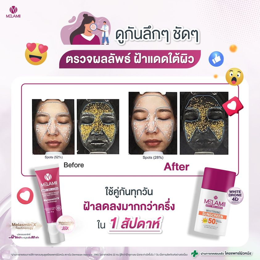 35G x2 l Melamii ครีมทาฝ้ากระจุดด่างดำ - รูปที่ 3