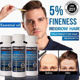 Kirkland 5%, Minoxidil and Hair Regrowth Growth of beard เซรัม ผมร่วง หัวล้าน ปลูกผม ปลูกหนวด สำหรับผู้ชาย 60 ml