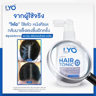 LYO Hair Tonic 100ml เซรั่มบำรุงผม ลดผมร่วง สำหรับผมบาง