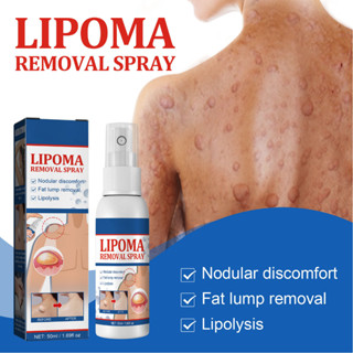 Aday Beauty 50ml Lipoma Lump Remover ลดความเจ็บปวดสมุนไพรขจัดไขมันสลายไขมันไม่เจ็บปวด