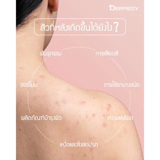 Dermedy Better Back Acne Spray 50ml เดอร์มีดี้ เบทเทอร์แบคแอคเน่สเปรย์ 50มล