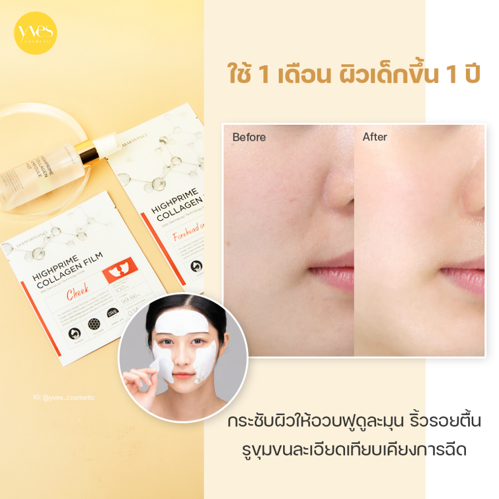 🌟พร้อมส่ง!!!🌟DERMARSSANCE Highprime Collagen (พร้อมส่ง3สูตร) ไฮไพรม์ คอลลาเจน ฟิล์ม  ยกกระชับ - รูปที่ 2