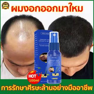 EELHOE 30ml สเปรย์ปลูกผม เซรั่มบำรุงเส้นผม เร่งผมขึ้นใหม่ น้ำยาเร่งผมยาว เซรั่มปลูกผม แก้ปัญหาผมร่วง น้ำยาปลูกผม ป้องกัน